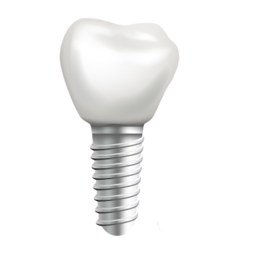 Установка имплантов даже в самых сложных случаях